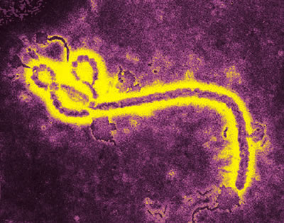 Ebola_jpg.jpg